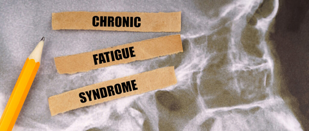 Chronic Fatigue Syndrome